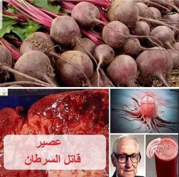 البنجر