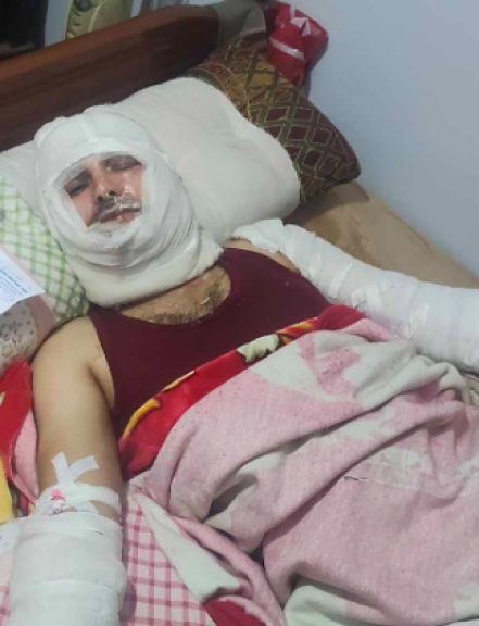 المجني علية